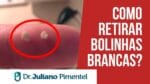 Como Retirar Bolinhas Brancas Das Amígdalas? | Dr. Juliano Pimentel
