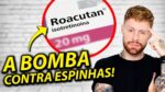 ROACUTAN: Minha Experiência com o Tratamento para Espinhas, funciona MESMO?