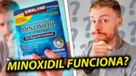 MINOXIDIL PRA BARBA: Tirei todas as DÚVIDAS sobre o TRATAMENTO! Ele Funciona? (feat. Alex Cursino)