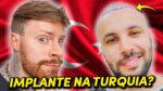 IMPLANTE CAPILAR! Preço? Fora do Brasil? Método FUE! TUDO sobre o Procedimento (feat. Nerd Sedutor)