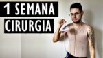 VLOG – PRIMEIRA SEMANA DE CIRURGIA, COMO FOI? | Menino Prendado