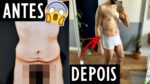 PERGUNTAS SOBRE A CIRURGIA – DOR, RECUPERAÇÃO E ANTES E DEPOIS | Menino Prendado