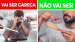 Os 5 SINAIS da CALVÍCIE: Como DESCOBRIR se você vai ficar CARECA?