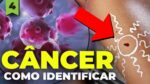 COMO UMA SIMPLES PINTA PODE SER CÂNCER | Câncer Explicado #4