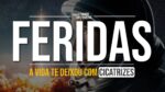 *LEMBRE-SE DOS TEMPOS QUE A VIDA TE BATIA SEM REMORSO.* | MOTIVAÇÃO