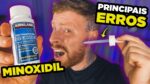 MINOXIDIL: 5 ERROS ao usar que DESTROEM o EFEITO do TRATAMENTO (Parte 02)
