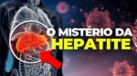 A HEPATITE MISTERIOSA que está ASSUSTANDO o mundo