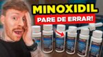 Como Usar o MINOXIDIL da MANEIRA CORRETA? 5 PASSOS SIMPLES pra VOCÊ NÃO ERRAR ao fazer o TRATAMENTO