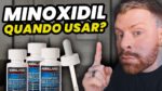 Será que o MINOXIDIL é pra VOCÊ? Descubra quando Recorrer ao TRATAMENTO pra BARBA