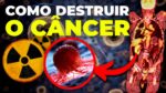 CÂNCER: O EXAME SECRETO QUE JÁ SALVOU MILHÕES DE PESSOAS